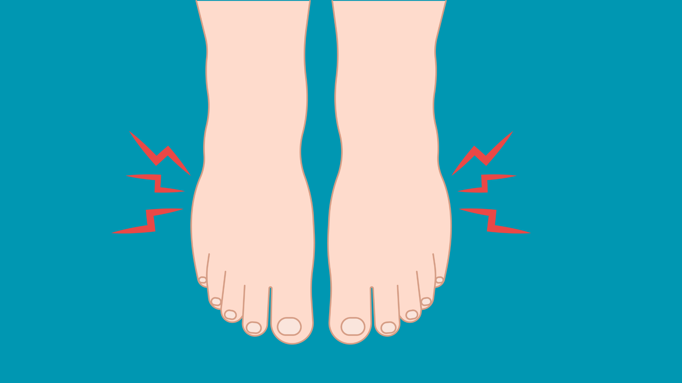 Swelling