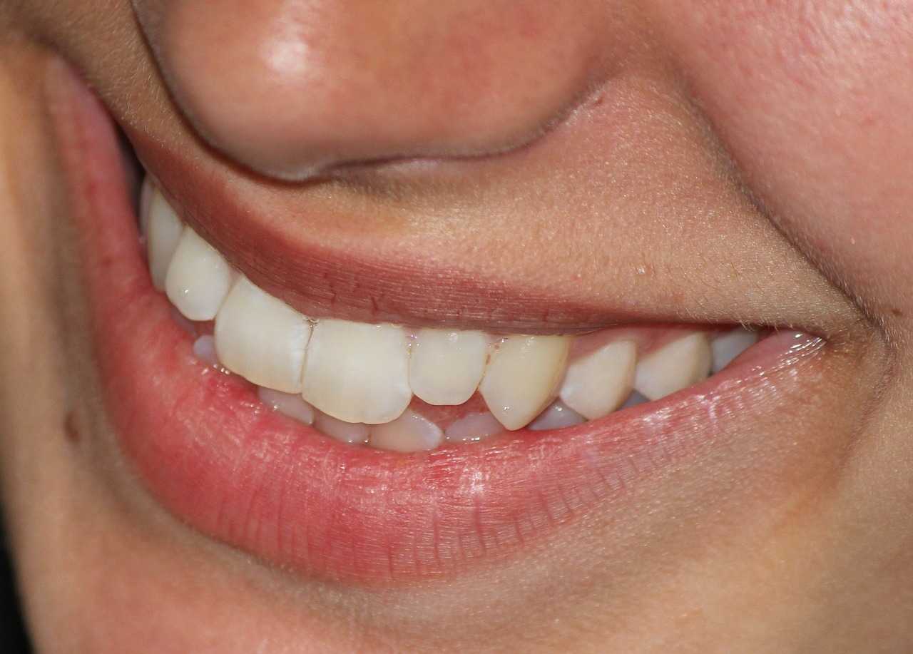Maintain Healthy Teeth and Gums