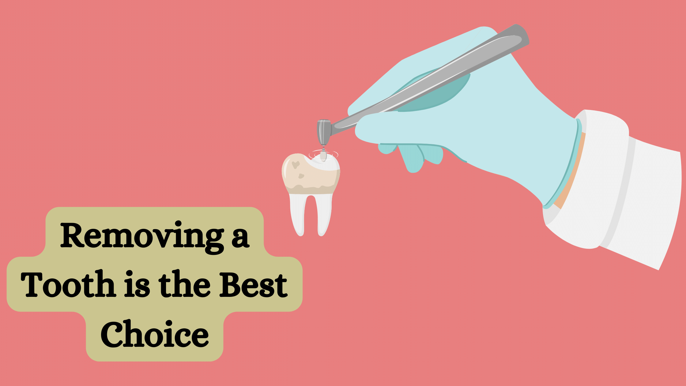 When Removing a Tooth is the Best Choice
