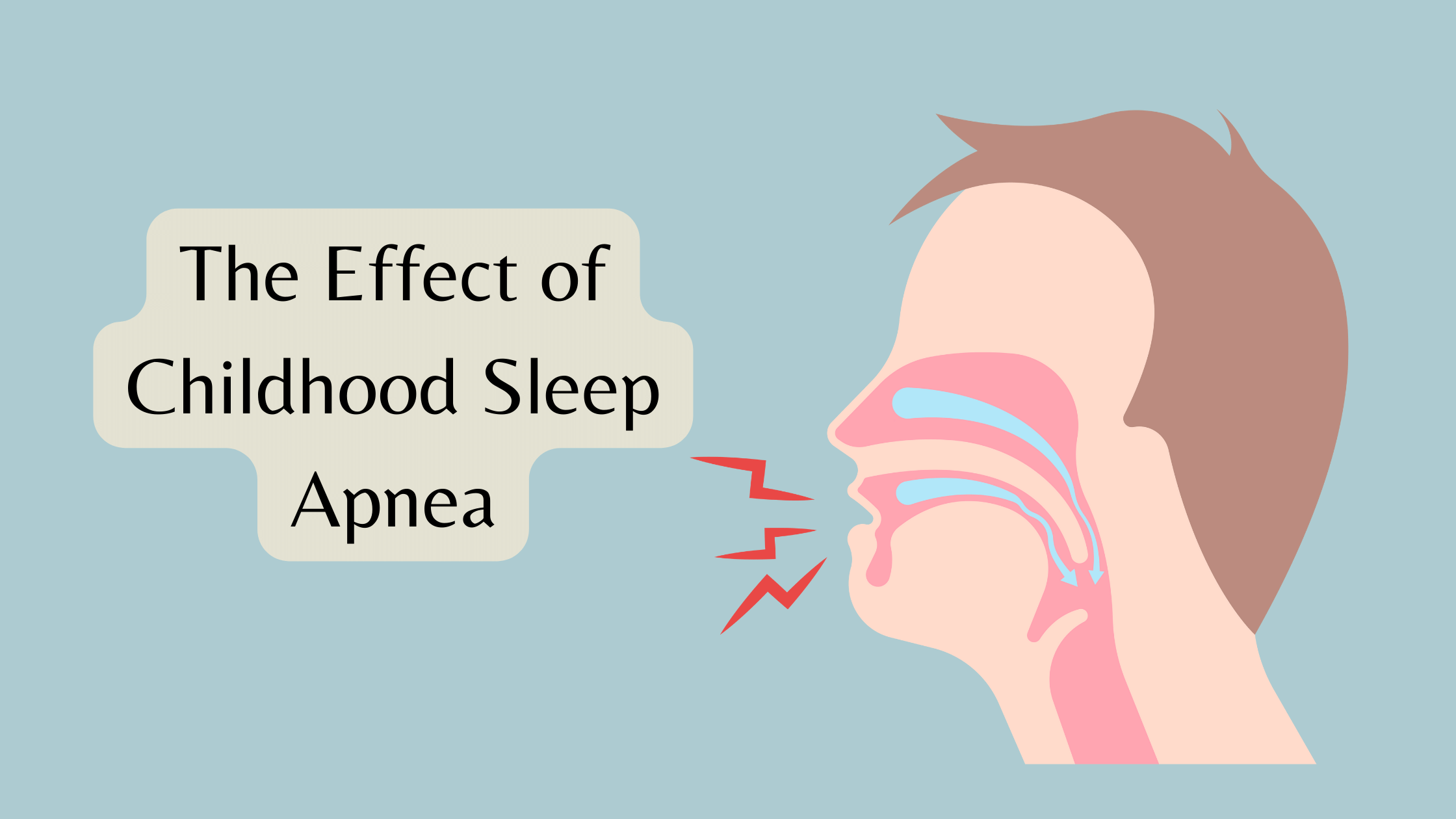 Childhood Sleep Apnea