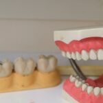 teeth and dental cast models